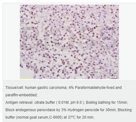 607644139c2be.png image.png